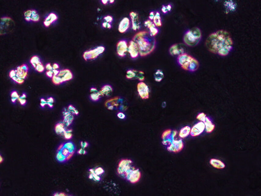 Calcium oxalate monohydrate crystals