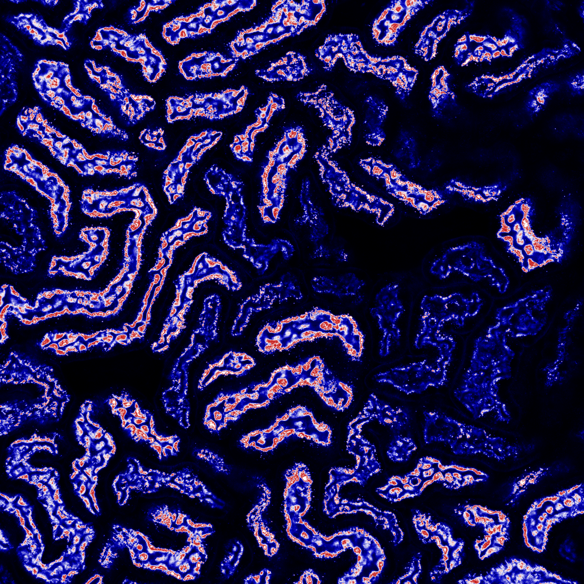 Drug delivery system targeting kidney