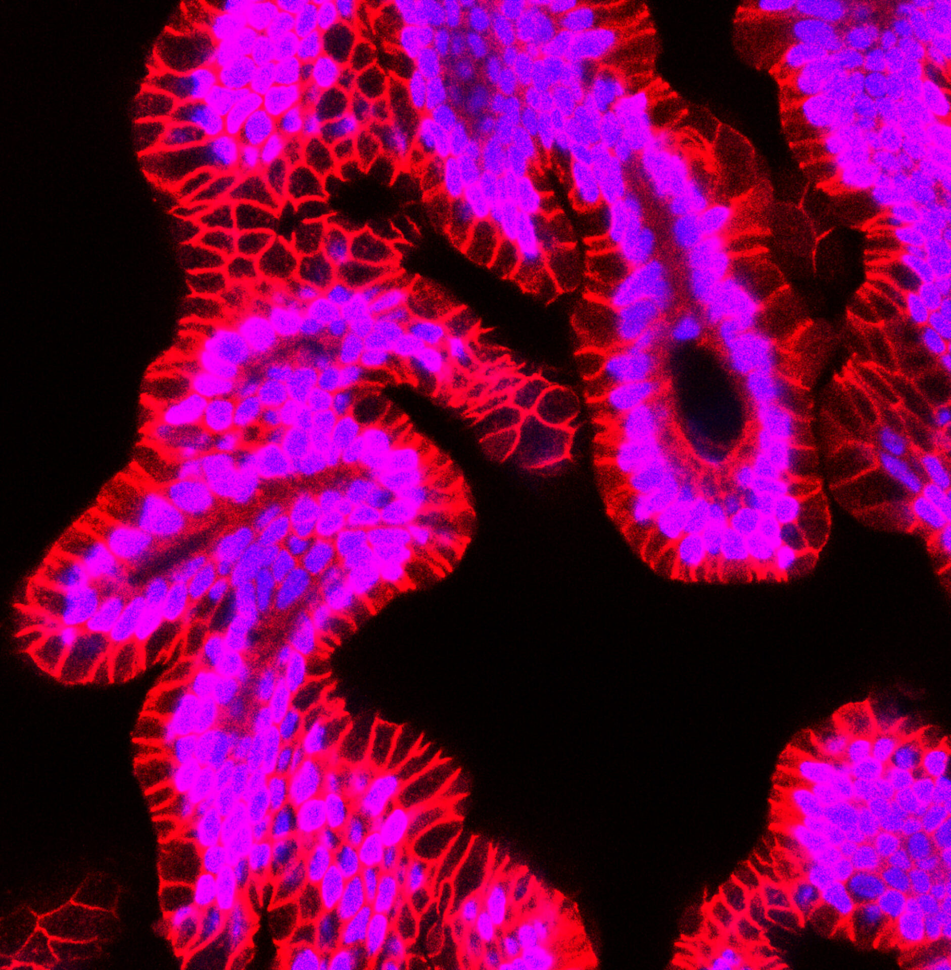 Adult human kidney organoids