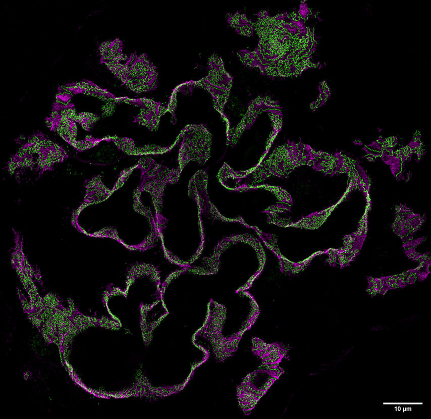 A human glomerulus