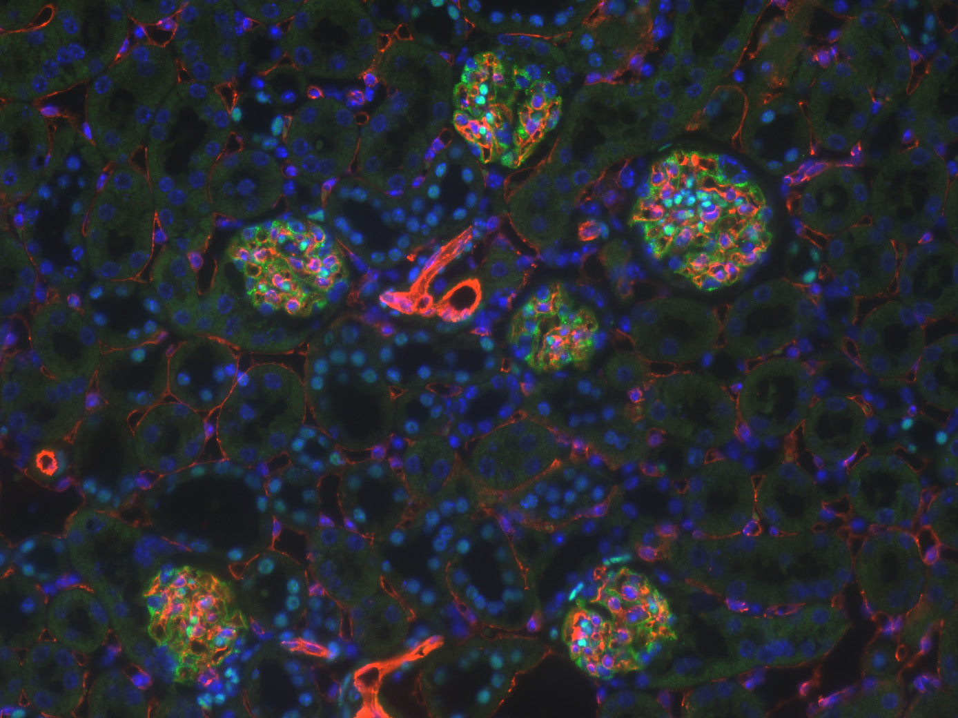 Sandra Rayego Mateos, Spain