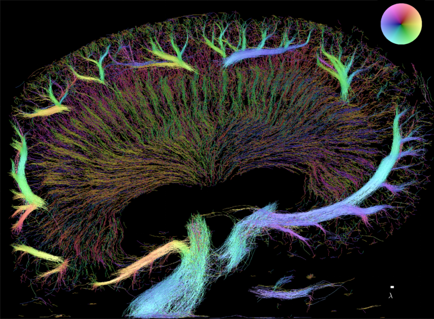 Mapping the Diabetic Kidney Microvasculature