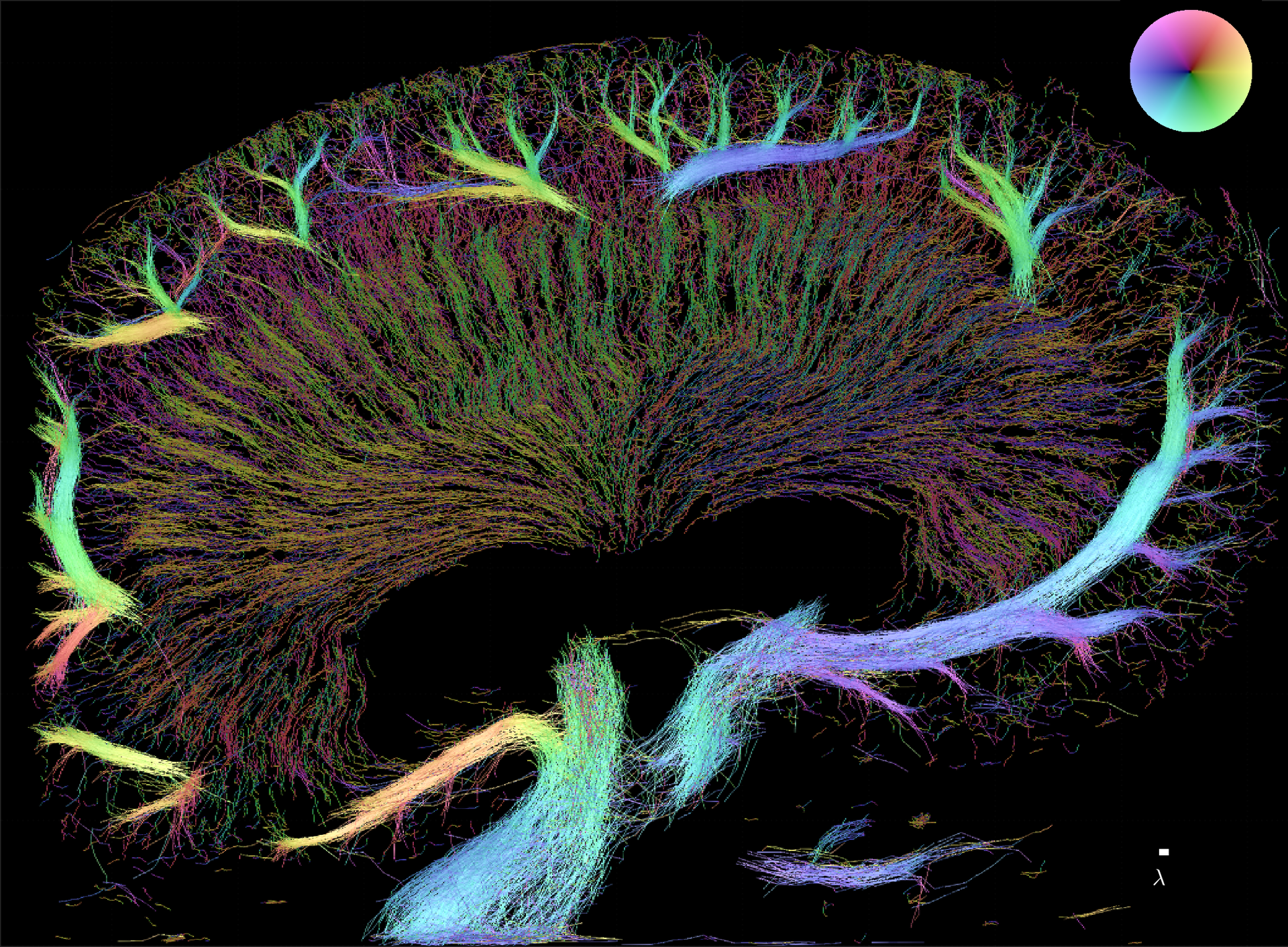 Mapping the Diabetic Kidney Microvasculature